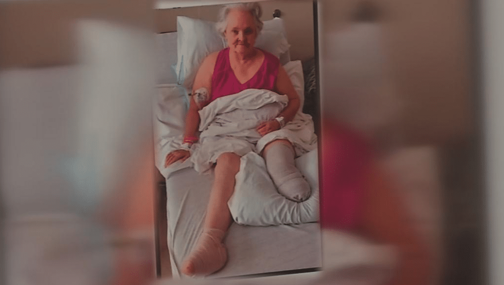 Carolyn Boerste recovering in a hospital bed after a below-the-knee amputation caused by retained surgical sponge complications | Daniel Stark Injury Lawyers